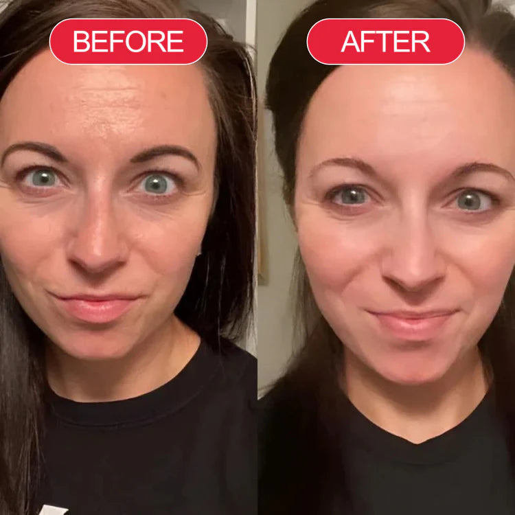 Before and after customer result