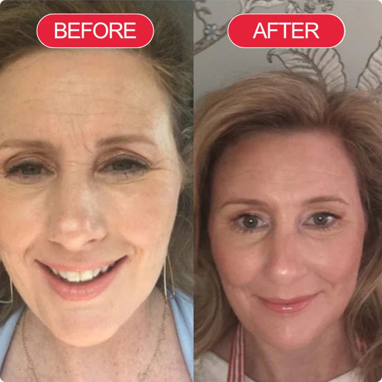 Before and after customer result