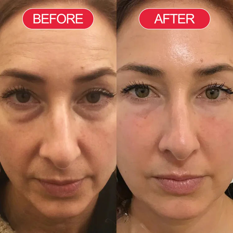 Before and after customer result