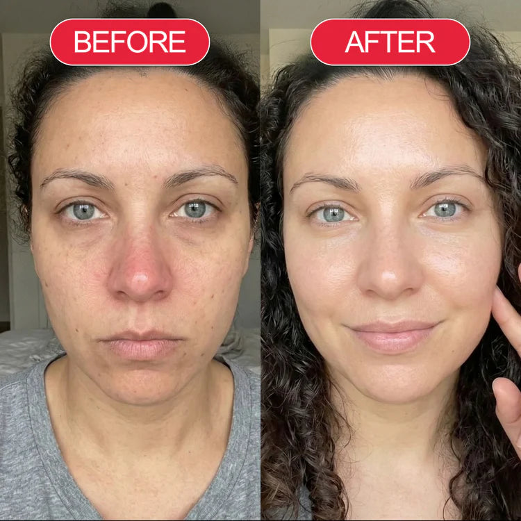 Before and after customer result
