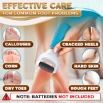 Battery Operated Foot Callus Remover for Dead Skin, Exfoliating Tool - Image 8