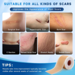 Silicone Scar Sheets, Silicone Scar Tape(1.8” X 157” Roll 4M) - Image 3