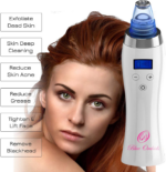Blackhead Remover Pore Vacuum for Face,  Dermasuction for Whitehead Removal, Acne Pimple Sucker, Face Vacuum Pore Cleanser, Comedone Extractor, 5 Adjustable Suction Power with 4 Probes - Image 4