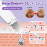 Electric Ultrasonic Skin Scrubber Vibration Face Spatula Peeling Blackhead Remover Facial Lifting Cleansing Ultrasonic Skin Care - Image 5